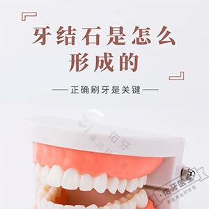 牙结石是怎么形成的?